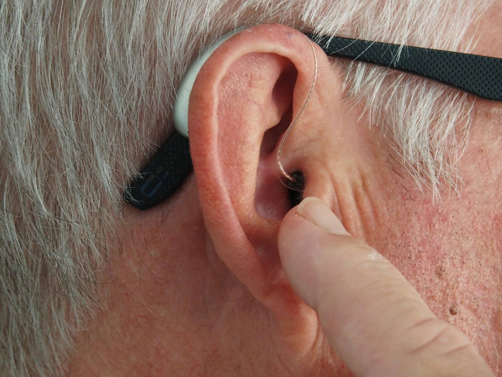 Child receiving cochlear implant rehabilitation and Auditory Verbal Therapy